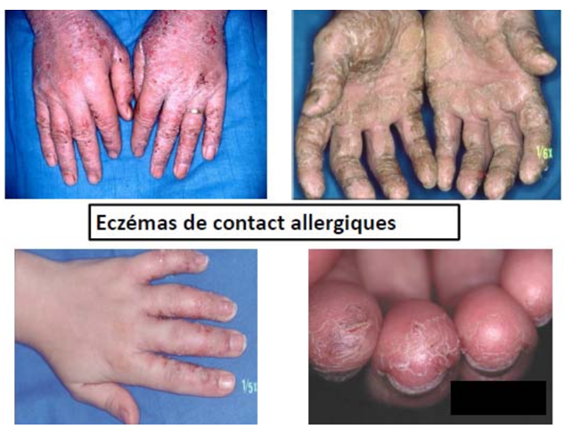 Ces dangers cachés qui sabotent votre peau : comment les repérer et les éviter