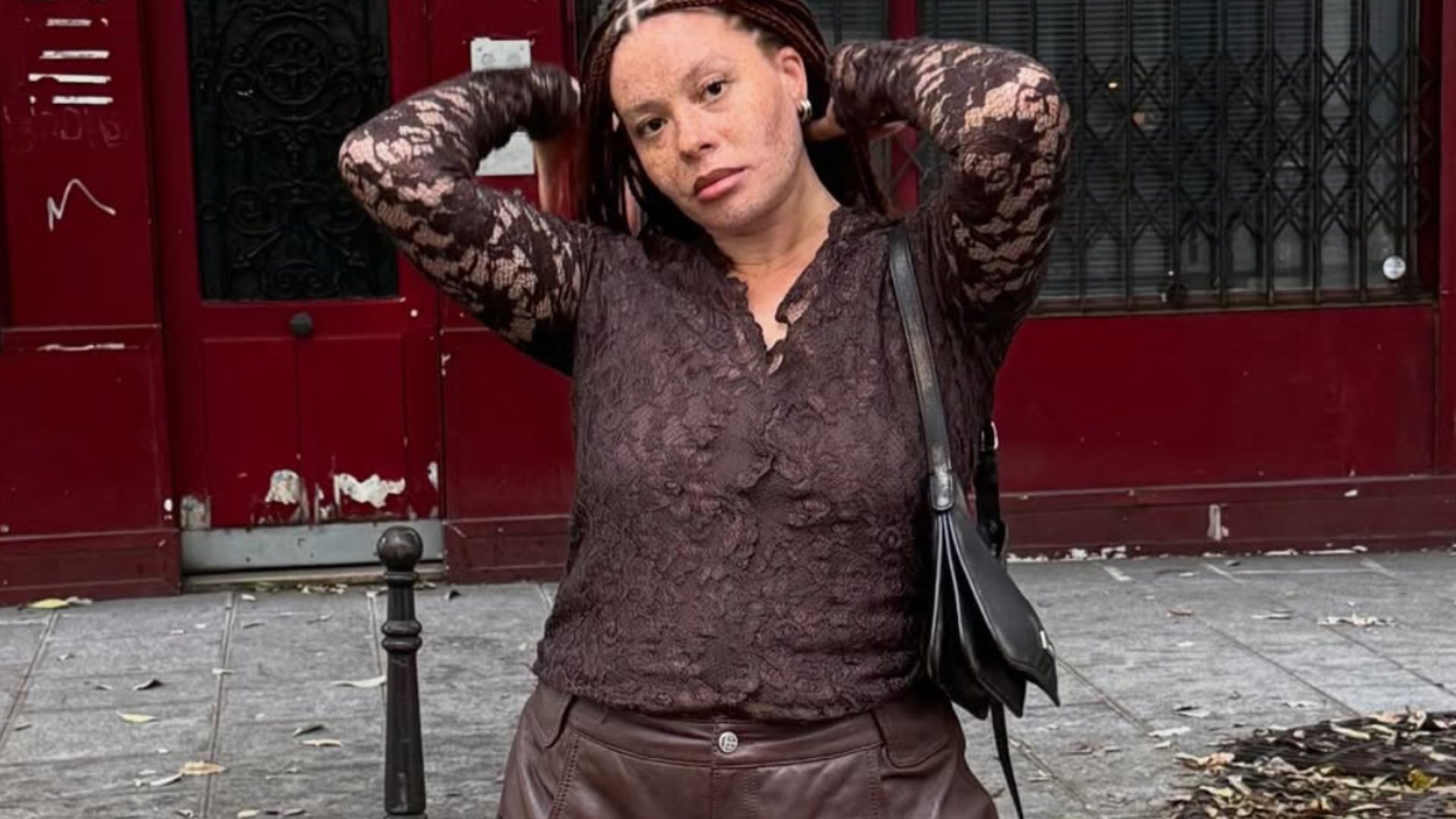 Cette mannequin célèbre ses taches de rousseur comme un symbole de beauté vraie et naturelle