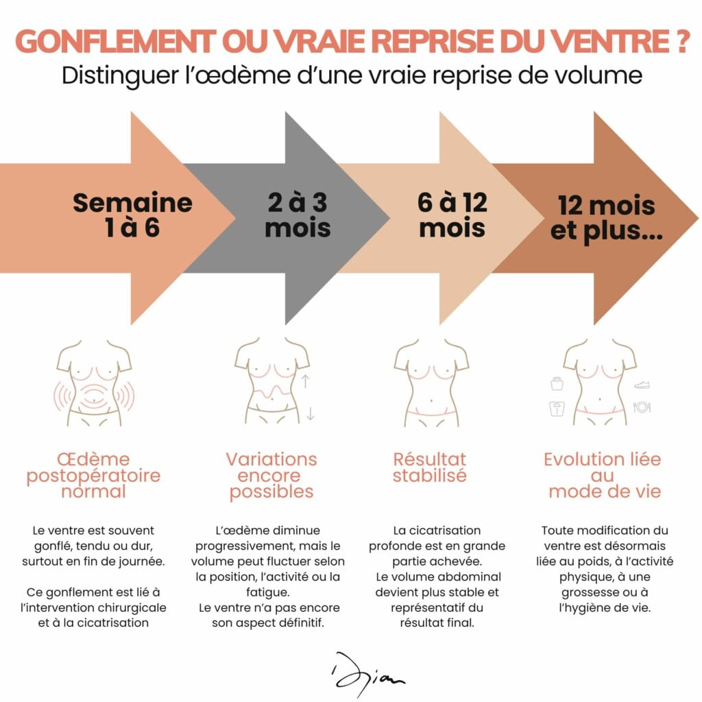Le « ventre hormonal » : comprendre son impact réel au-delà des diktats esthétiques